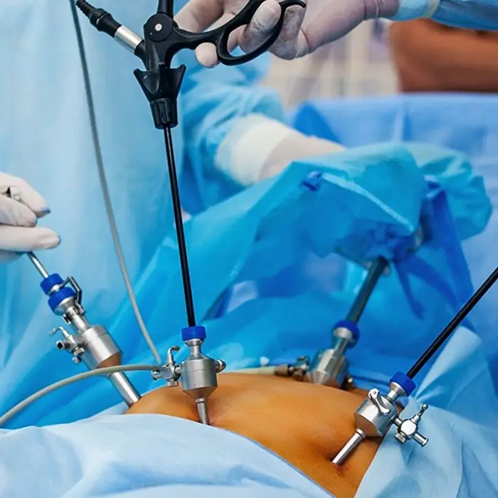Laparoscopic